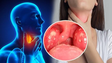 गले में चुभन क्यों होती है | गले में चुभन होने का कारण जानकर रह जायेंगे दंग | Boldsky