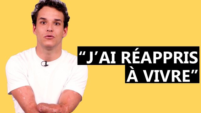 Théo Curin amputé des bras et des jambes, sa leçon de vie inspirante