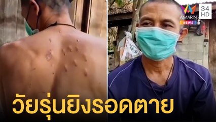 ลุงถูกวัยรุ่นยิงกระสุนฝังร่าง 50 นัด รอดตายปาฏิหาริย์ | ข่าวเที่ยงอมรินทร์ | 3 พ.ค.65