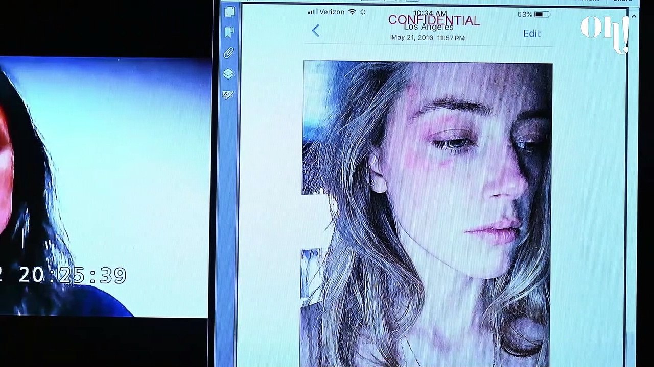 Krankenschwester sagt im Prozess aus: Amber Heard 'labil' und 'eifersüchtig'