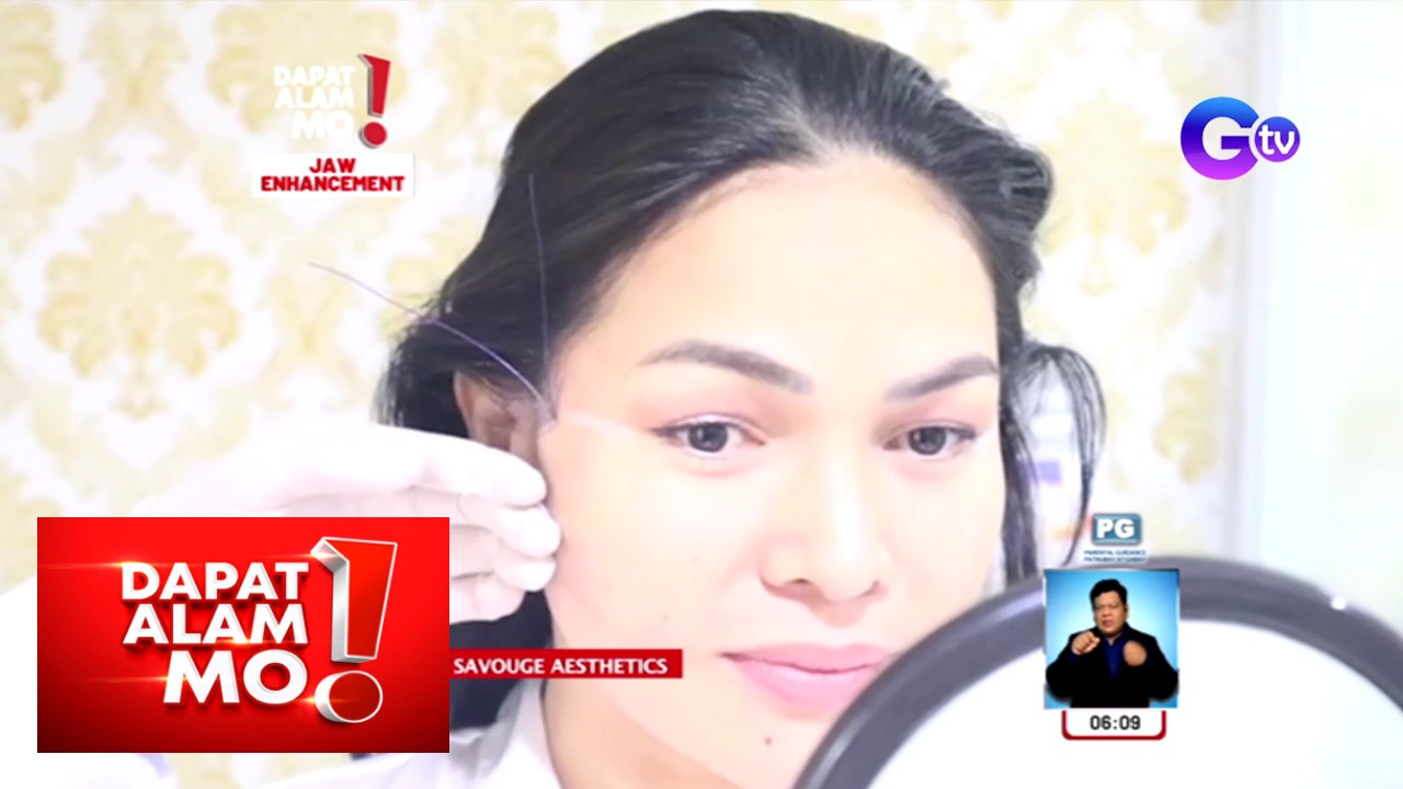 Dapat Alam Mo!: Inaasam na v-shaped na panga, paano ma-achieve?