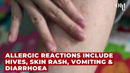 This tick can make you allergic to red meat: Here’s how to spot it