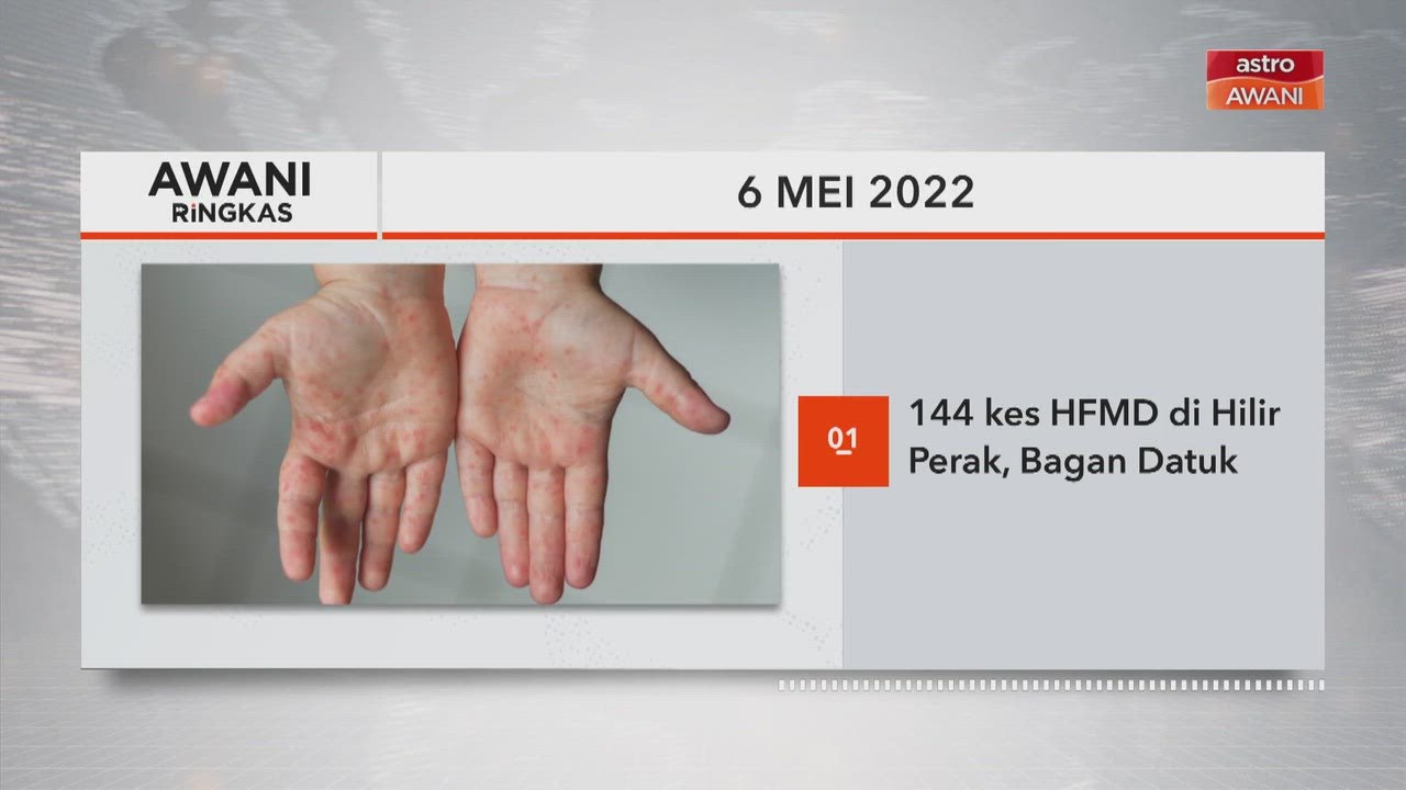 AWANI Ringkas: 144 kes HFMD di Hilir Perak, Bagan Datuk