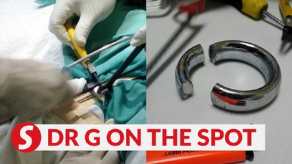 EP118: ‘Lord of the Ring’ goes awry | PUTTING DR G ON THE SPOT