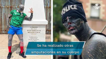 Hombre que quiere convertirse en alíen ahora se quitará una pierna para su transformación