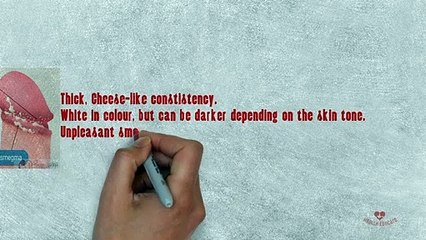 smegma - White sticky cheesy around the the foreskin