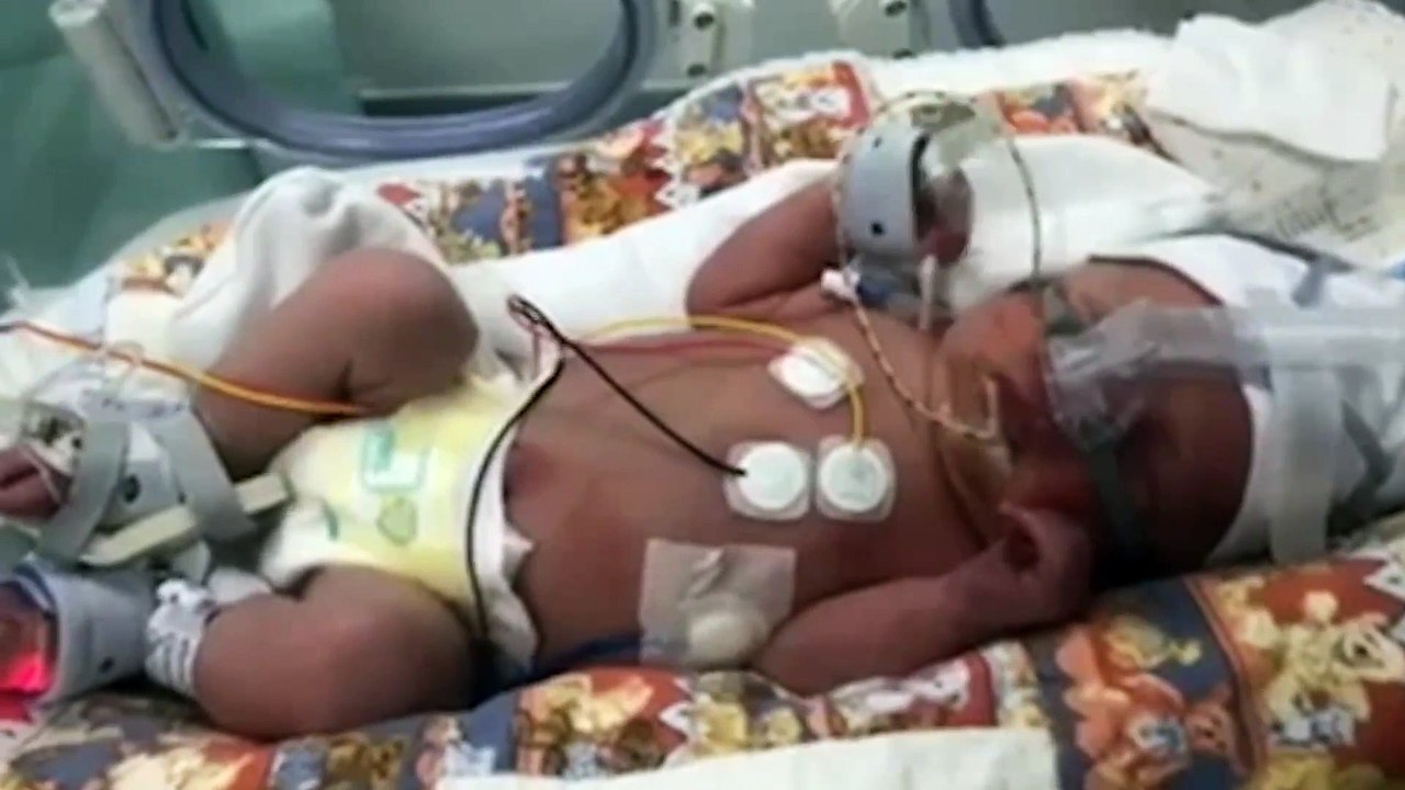First-time mum caught Covid before giving birth and slipping into a COMA