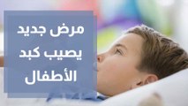 التهاب يصيب الكبد ينتشر بين الأطفال