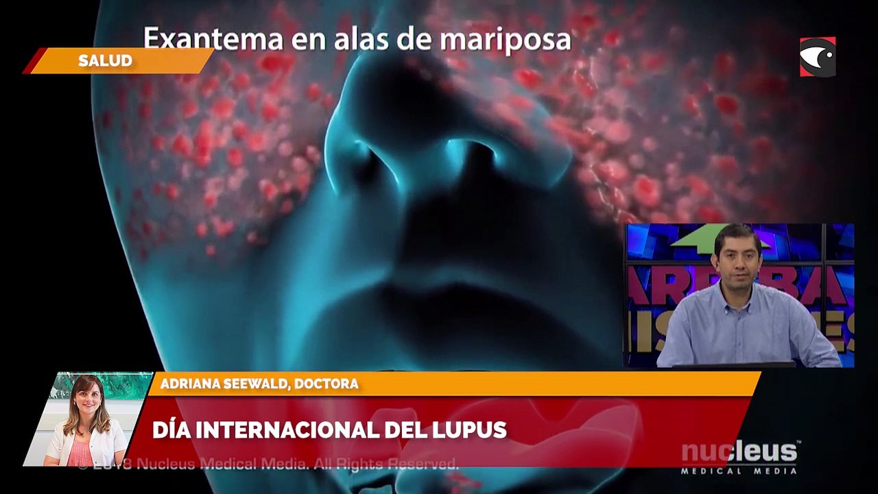Día internacional del lupus