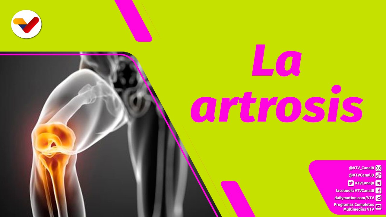 Buena Vibra | Síntomas que demuestran que sufres de artrosis de rodilla