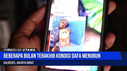 Balita Penderita Gizi Buruk di Kalideres Mulai Membaik