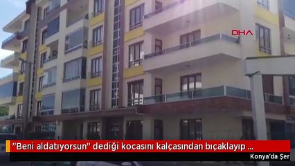 'Beni aldatıyorsun' deyip kocasını kalçasından bıçakladı!