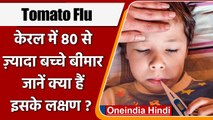 Tomato Flu: Kerala में नया खतरा, 80 से ज्यादा बच्चे बीमार | वनइंडिया हिंदी