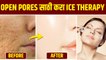 चेहऱ्यावरील ओपन पोर्सने त्रस्त आहात | How To Get Rid Open Pores On Face | Open Pores Treatment
