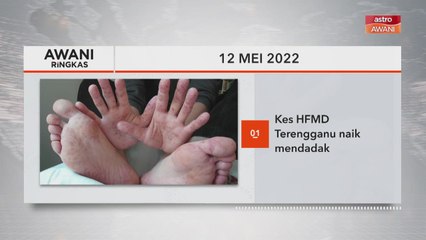 AWANI Ringkas: Kes HFMD Terengganu naik mendadak | Pemandu Myvi samseng ditahan