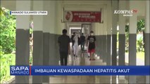 Pemerintah Keluarkan Imbauan Kewaspadaan Hepatitis Akut