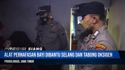 Polres Probolinggo Bantu Bayi Cacat Bawaan Lahir Keluarga Tak Mampu