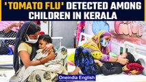 Tomato Flu spreads among children under the age of five in Kerala | OneIndia News