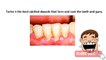 Tartar on teeth: How to safely remove tartar buildup on teeth at home