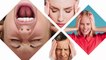 Migraine Can Cause Over 40 Symptoms | Discover the Diversity of Migraine Symptoms!