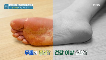 지속적인 발의 가려움증이 보내는 건강 신호는?