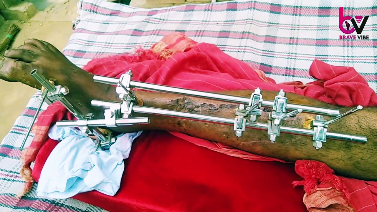 ਘਰ ਦਾ ਕਮਾਉਣ ਆਲਾ ਜੀਅ ਪਿਆ ਮੰਜੇ ਤੇ , ਇਸ ਪਰਿਵਾਰ ਨੇ ਲਗਾਈ ਮੱਦਦ ਦੀ ਗੁਹਾਰ, Brave Vibe