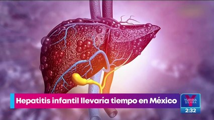 Hepatitis infantil aguda: ¿qué es y cuáles son los síntomas?