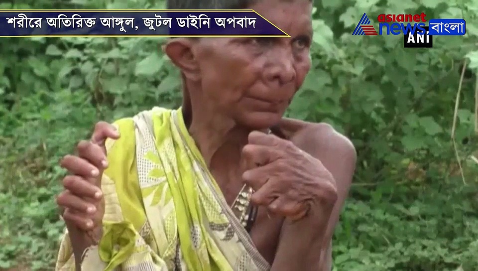 পায়ে ২০ আর হাতে ১২টা আঙ্গুল, ওড়িশার জীবন্ত বিস্ময় নয়ক কুমারী