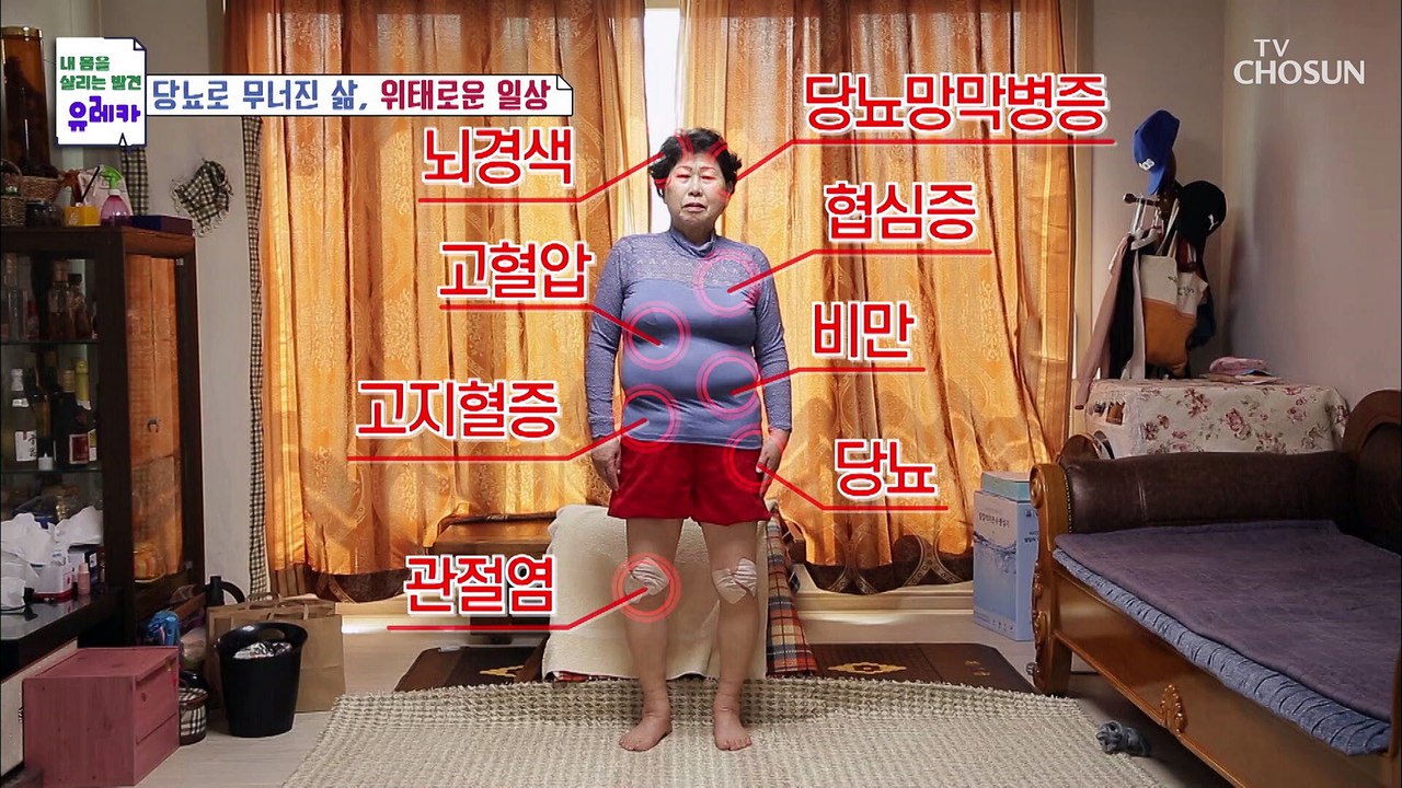 당뇨 합병증으로 생긴 무릎 통증&망가진 일상생활 TV CHOSUN 20220515 방송