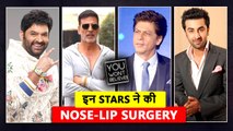  Bollywood Stars Who Had Plastic Surgery  | Shahid, Aamir, Shahrukh, Akshay