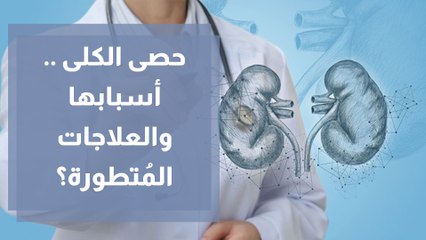 حصى الكلى... ما أسبابها وما العلاجات المُتطورة؟