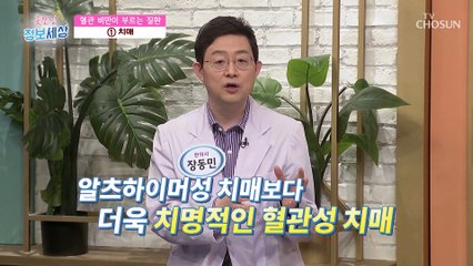 내 몸속 혈관에 노폐물과 지방이 쌓여 ‘혈관 비만’이 된다?! TV CHOSUN 220517 방송