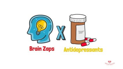 Brain Zaps : Electric sensations in the brain