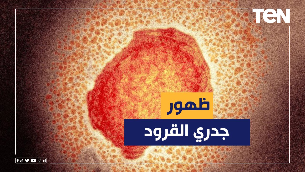منظمة الصحة العالمية تتوقع ظهور المزيد من حالات جدري القرود على مستوى العالم