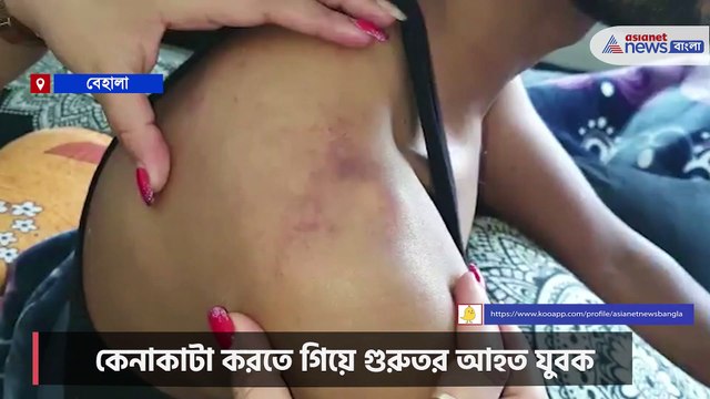 Allegation of beating a young man against Civic Volunteer
