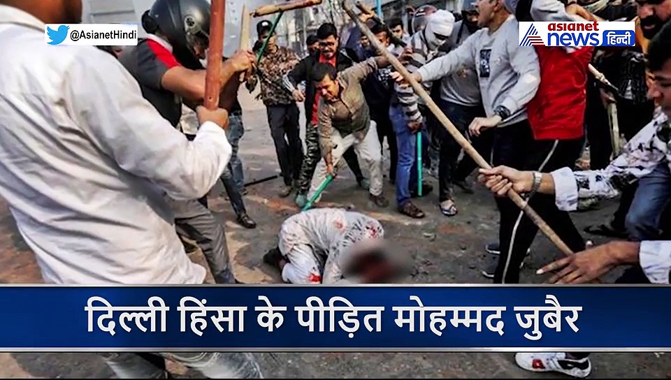 25 लोग लाठी डंडों से पीट रहे थे...लगा अब जिंदा नहीं बचूंगा, मोहम्मद जुबैर ने बताई आपबीती