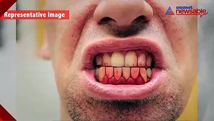 Dentist removes man's teeth, ends up killing him