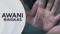 AWANI Ringkas: HFMD memburuk di Melaka, 12 premsi ditutup