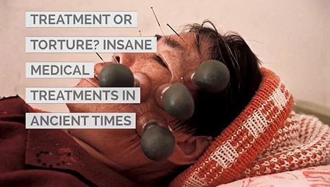 Treatment or Torture? Insane Medical Treatments in Ancient times