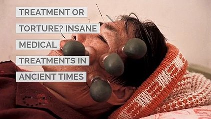 Treatment or Torture? Insane Medical Treatments in Ancient times
