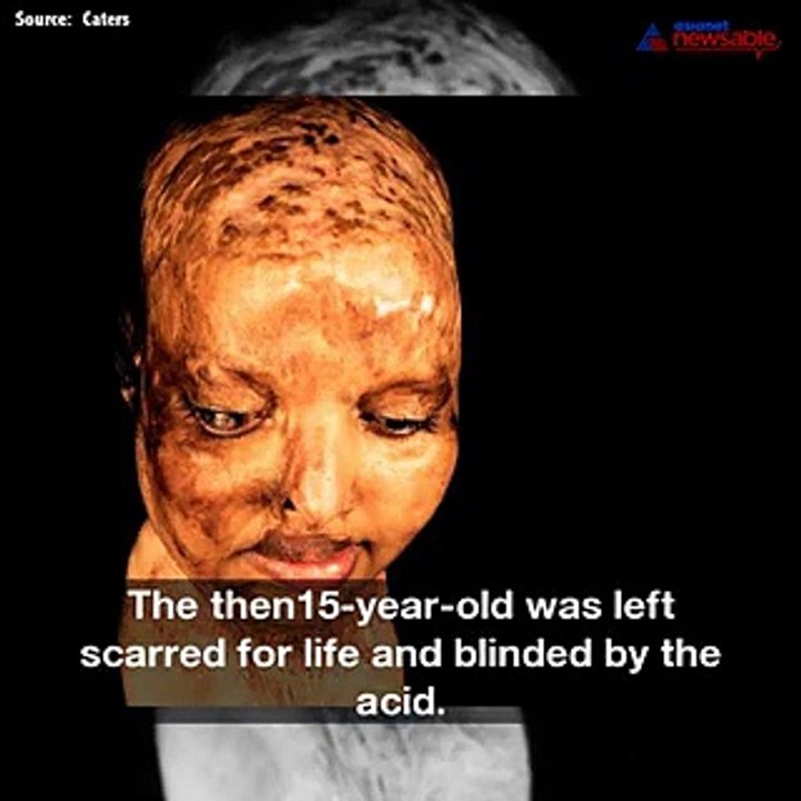 Justice Served! Indian soldier arrested over horrific acid attack that left 15-year-old girl blind