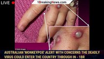 Australian 'monkeypox' alert with concerns the deadly virus could enter the country through in - 1br