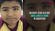 Boy honks with every breath after he swallows a horn