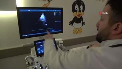 Genç kızın küçük yaşta tespit edilen kalp deliği kesiksiz onarıldı