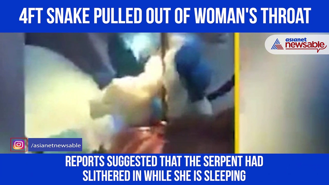 Doctors pull out snake from woman’s throat; video goes viral