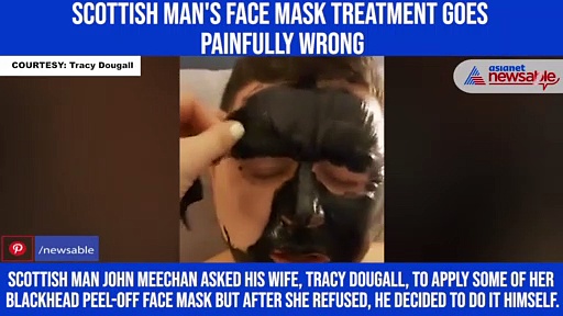 Scottish man's face mask treatment goes painfully wrong