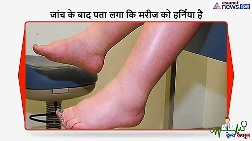 मरीज को खासने पर, खड़े होने पर आ रही थी सूजन, जांच के बाद पता चली ये बीमारी