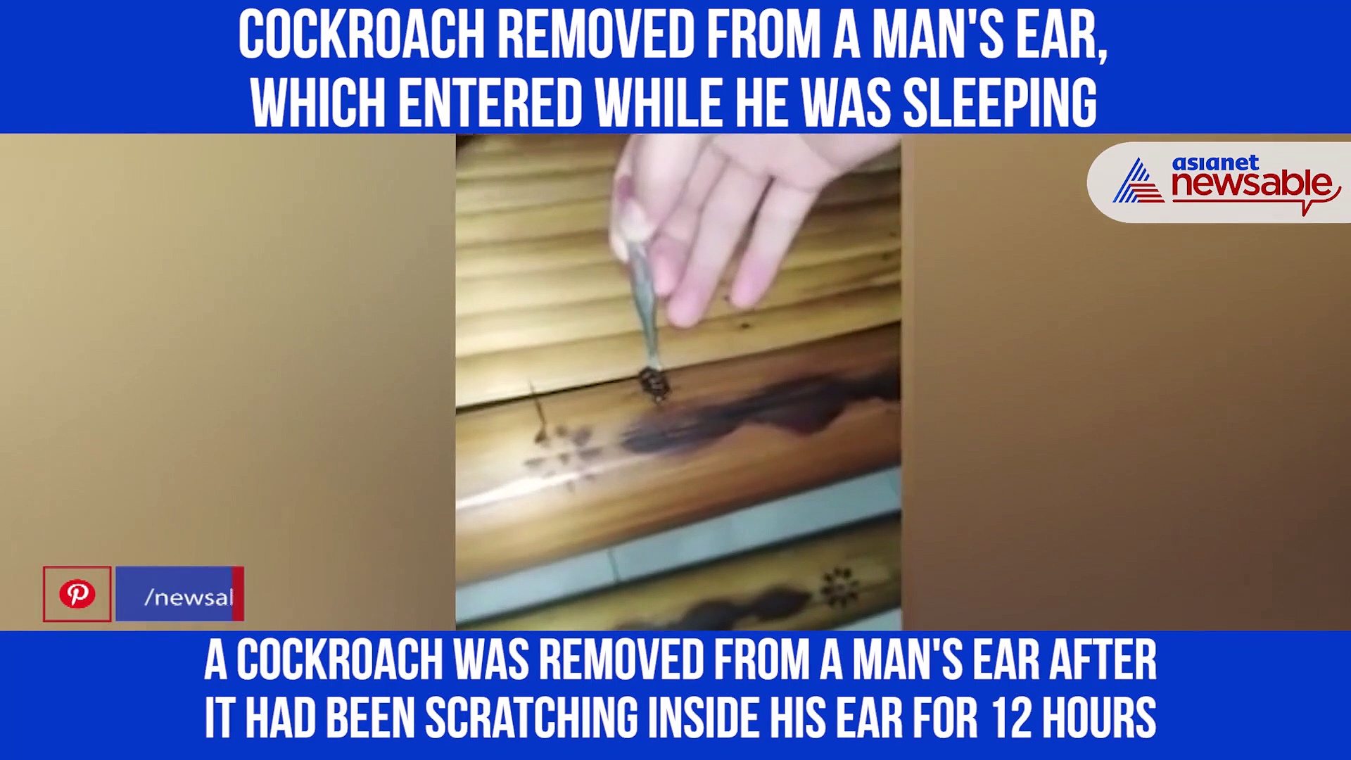 Here's how a cockroach was removed from a man's ear after he suffered inside his head