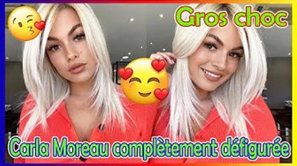 Nouvelles chaudes  Carla Moreau subit une opération de transformation dans un tout nouveau look 