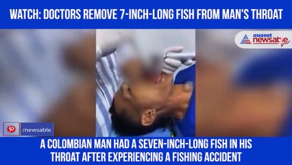 Fish Removed from Man's Throat